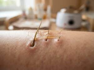 Haarwachstumsphasen Waxing